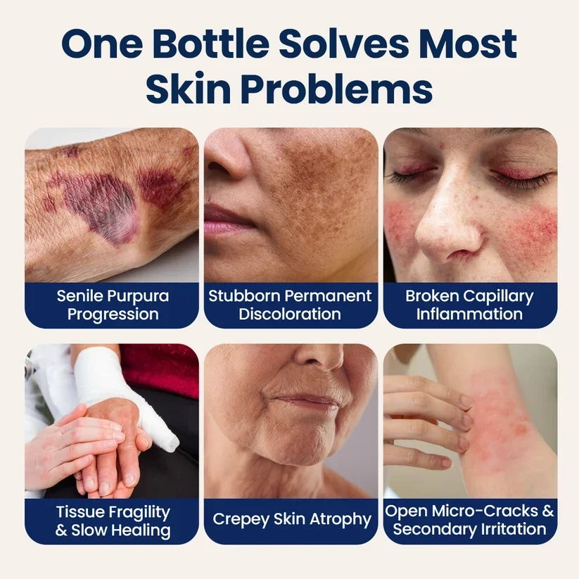 TOPSPIRE® ResiliVeil Bruise Appearance Barrier Care Cream