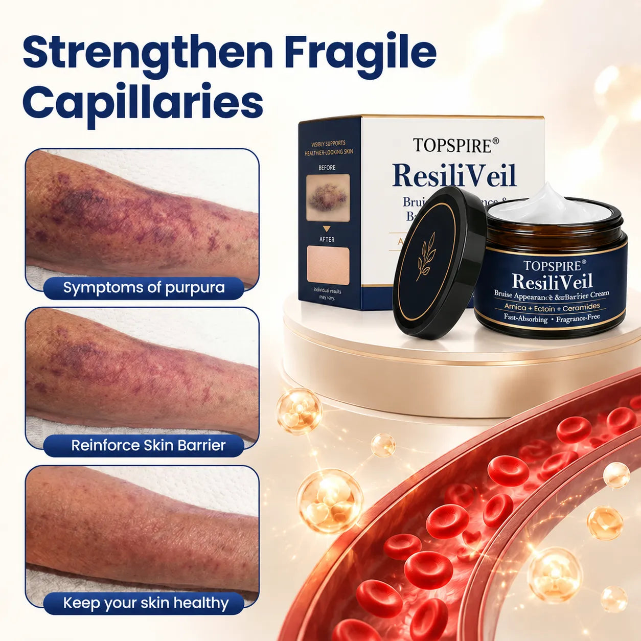 TOPSPIRE® ResiliVeil Bruise Appearance Barrier Care Cream