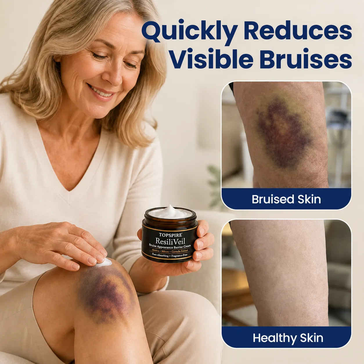 TOPSPIRE® ResiliVeil Bruise Appearance Barrier Care Cream