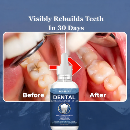 TOPSPIRE™ Advanced Enamel Repair & Whitening Kit (Includes Free LED Mirror)